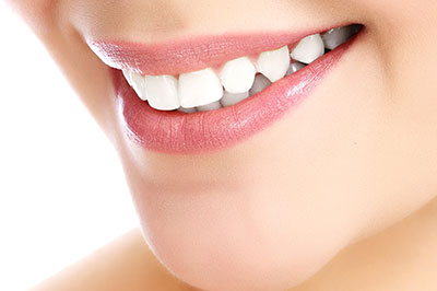 A close-up photograph of a smiling woman with white teeth and pink lipstick, showcasing her dental hygiene.