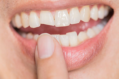 The image shows a close-up of a person s mouth with teeth, gums, and tongue visible, along with their hand holding a finger near their lips.
