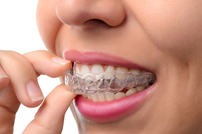 The image shows a person with a broad smile, wearing braces, holding a finger near their mouth, possibly examining their teeth or adjusting their braces.