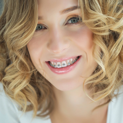 A woman with braces smiles at the camera, showcasing her smile.