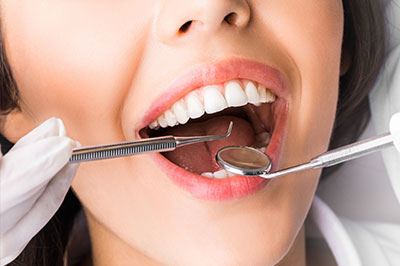 The image shows a woman with a large smile undergoing dental treatment, with a dentist s hand holding a dental mirror to her mouth while she receives care.