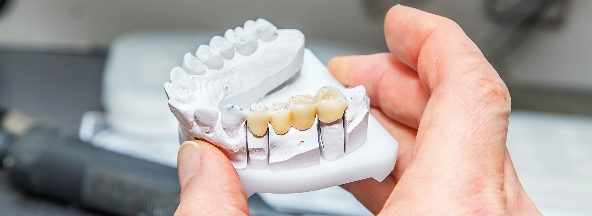 The image shows a person holding a white dental model with missing teeth, using a tool to manipulate the plastic teeth.