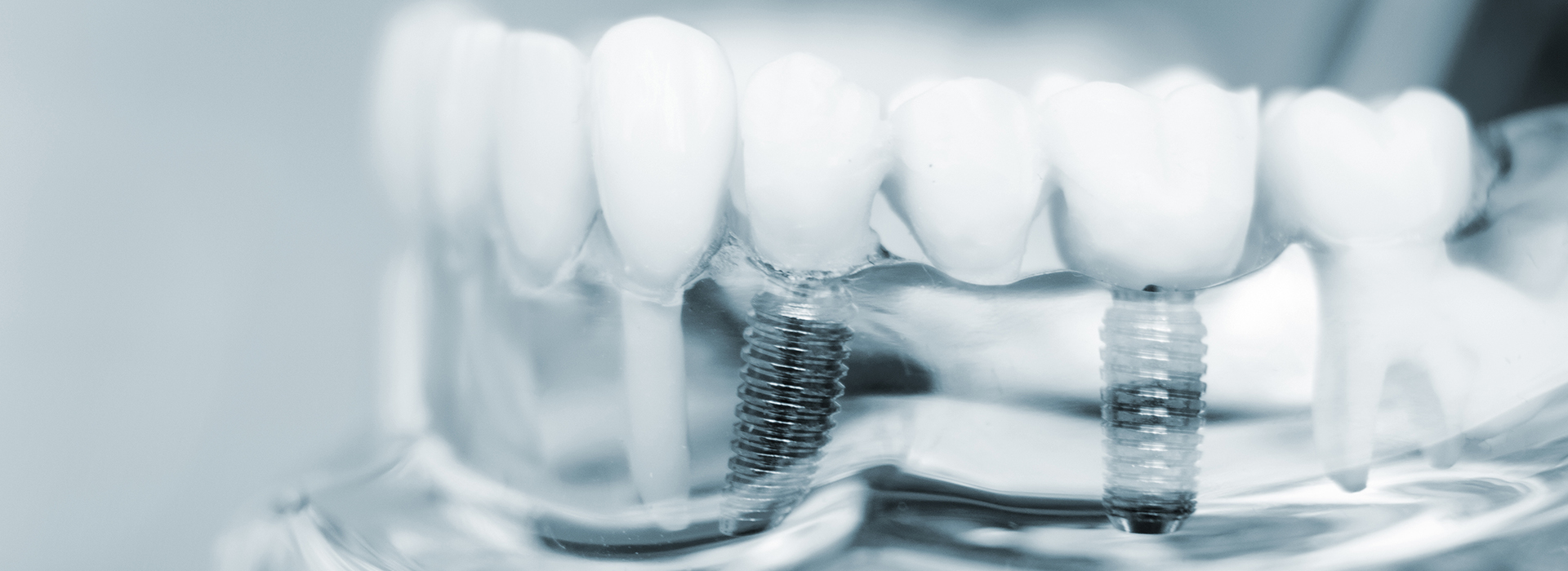 The image shows a close-up view of multiple toothbrushes with bristles, placed against a blurred background.