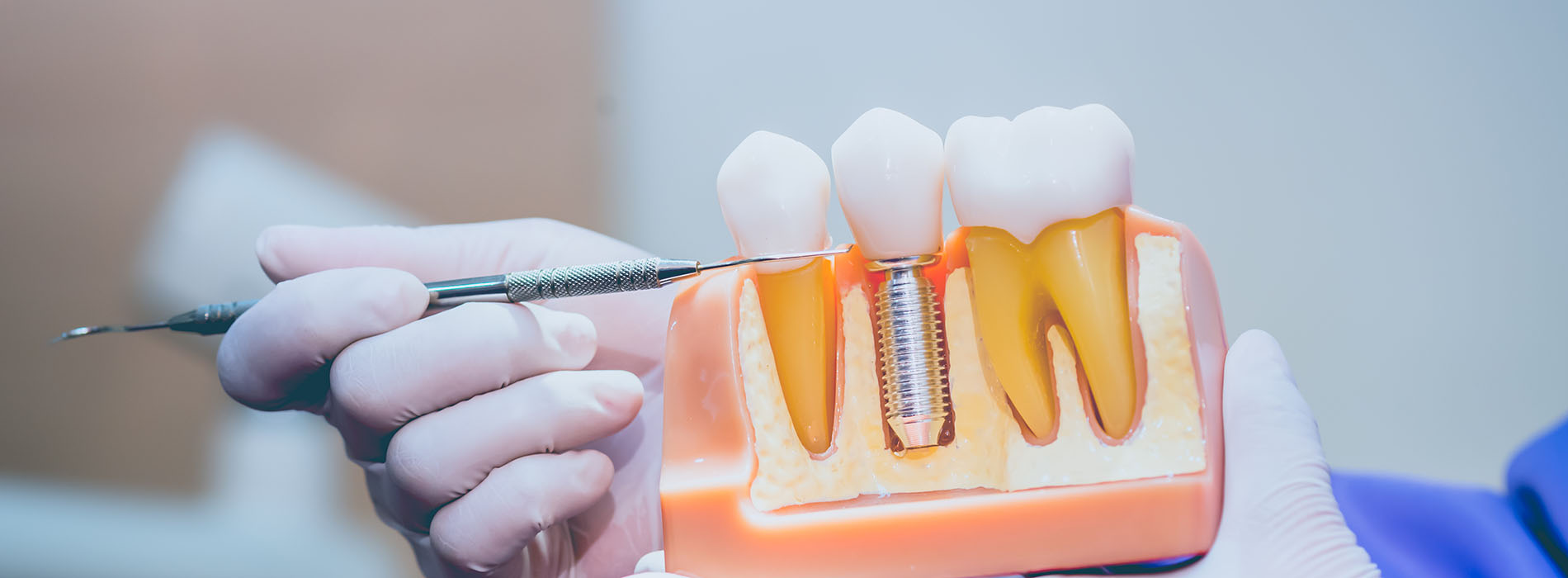 The image shows a close-up of a dental extraction being performed with a hand holding dental tools over an open mouth, focusing on the extraction process.