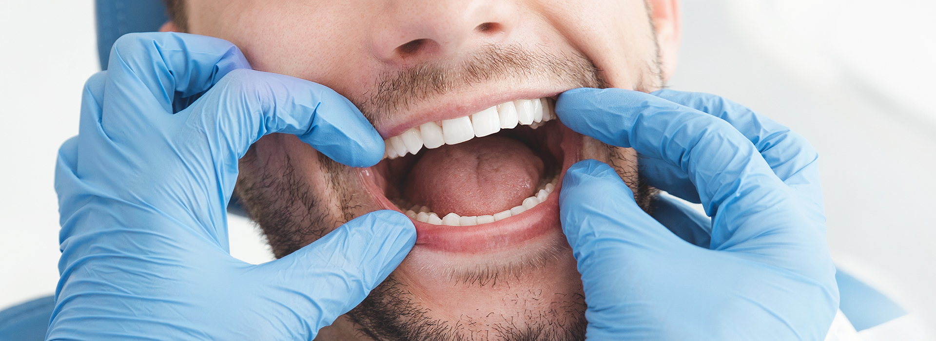A man with his mouth open, wearing blue gloves and a surgical mask, possibly in a medical setting.
